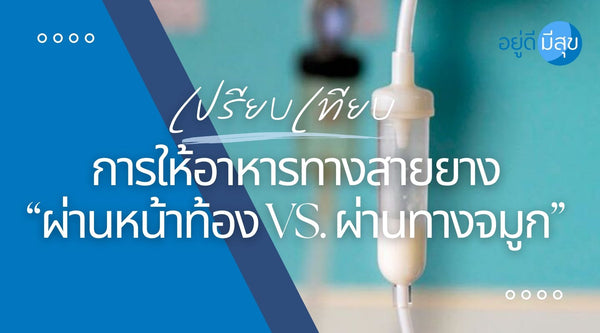 เปรียบเทียบการให้อาหารทางสายยาง “ผ่านหน้าท้อง VS. ผ่านทางจมูก”